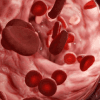 ApoB blood test measuring atherogenic lipoproteins and cardiovascular disease risk