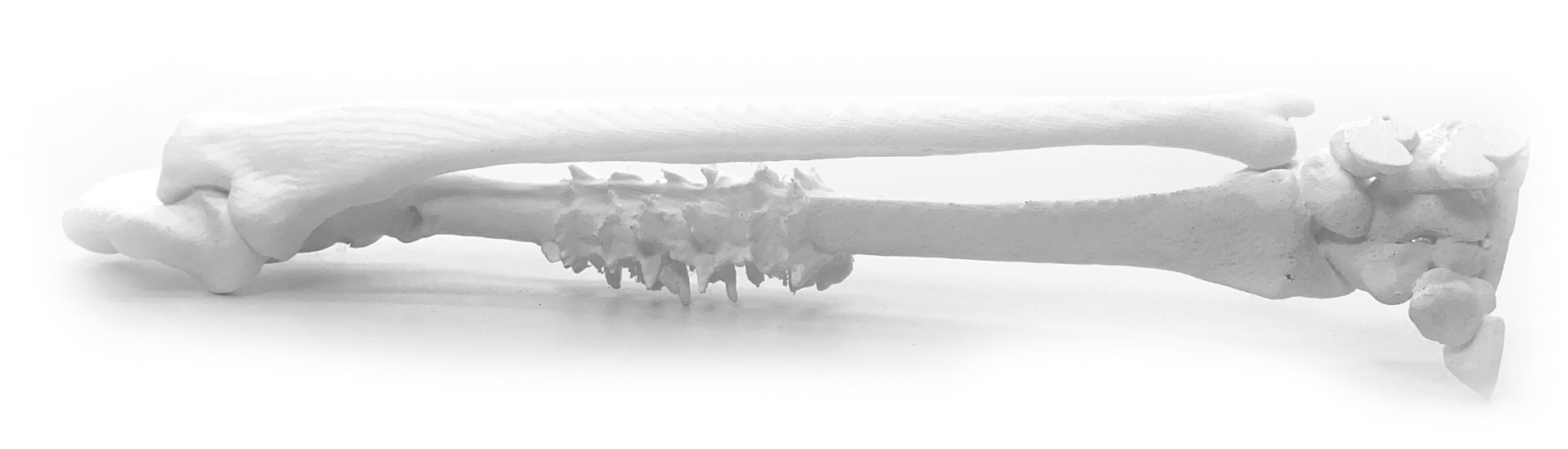 3d printed radius ulna forearm surgical planning medical model white polyterra pla
