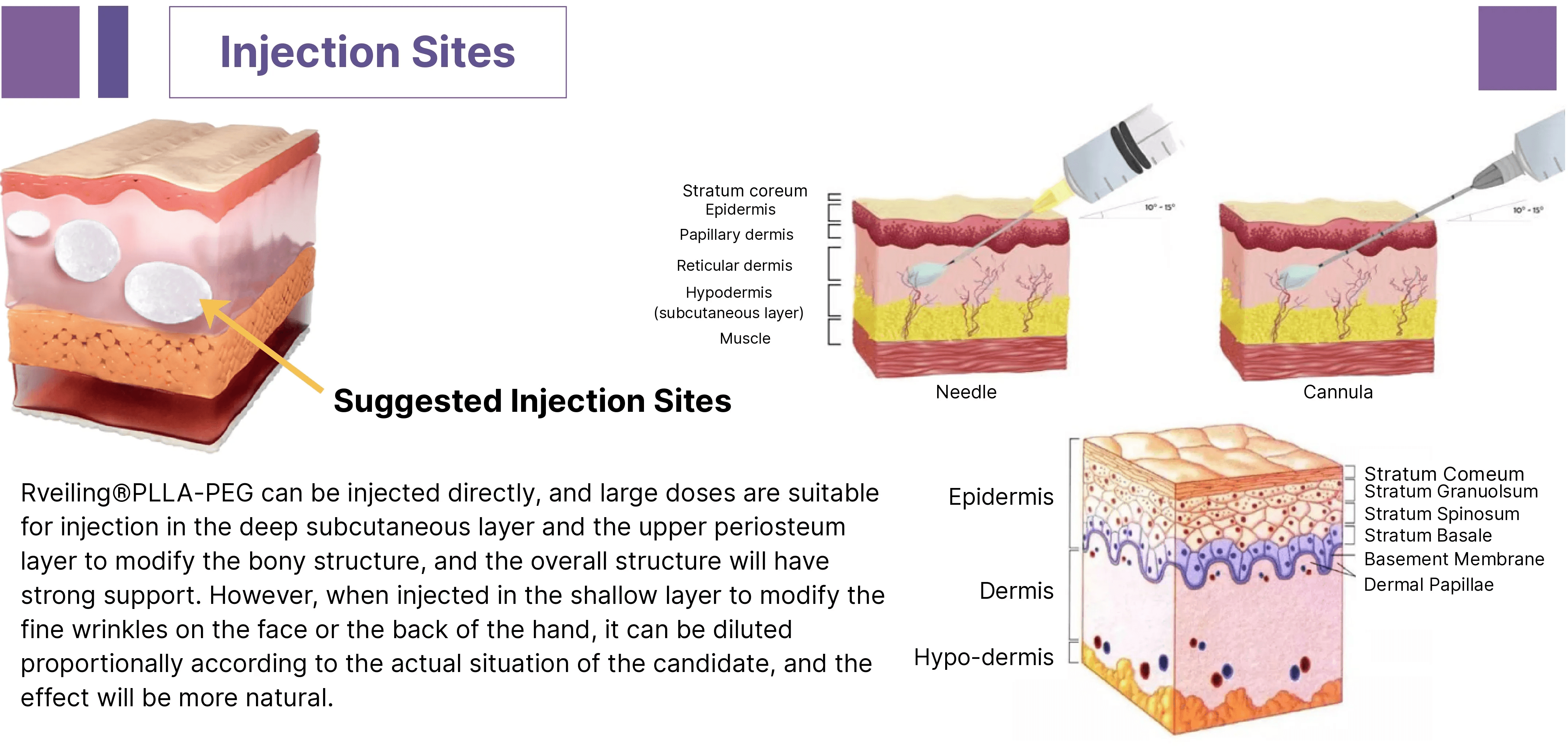 Aowita-Poly(L-lactic Acid) Injectable-Injection Sites