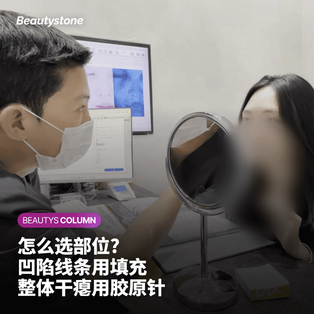 哪个部位适合哪种项目