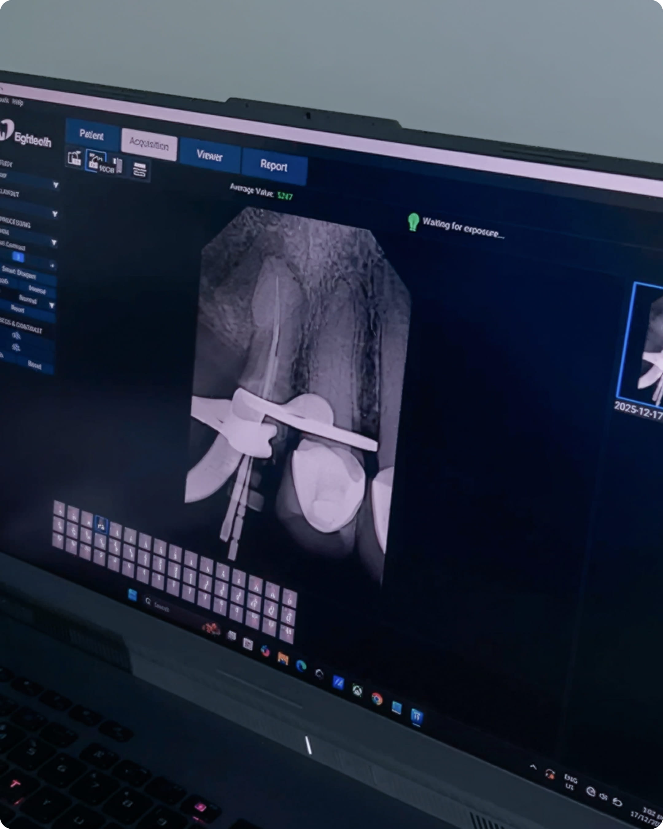 Advanced dental imaging for root canal Specialized dental treatment for gum disease and root canal therapy using advanced dental technology at K DentArtistry Makati.