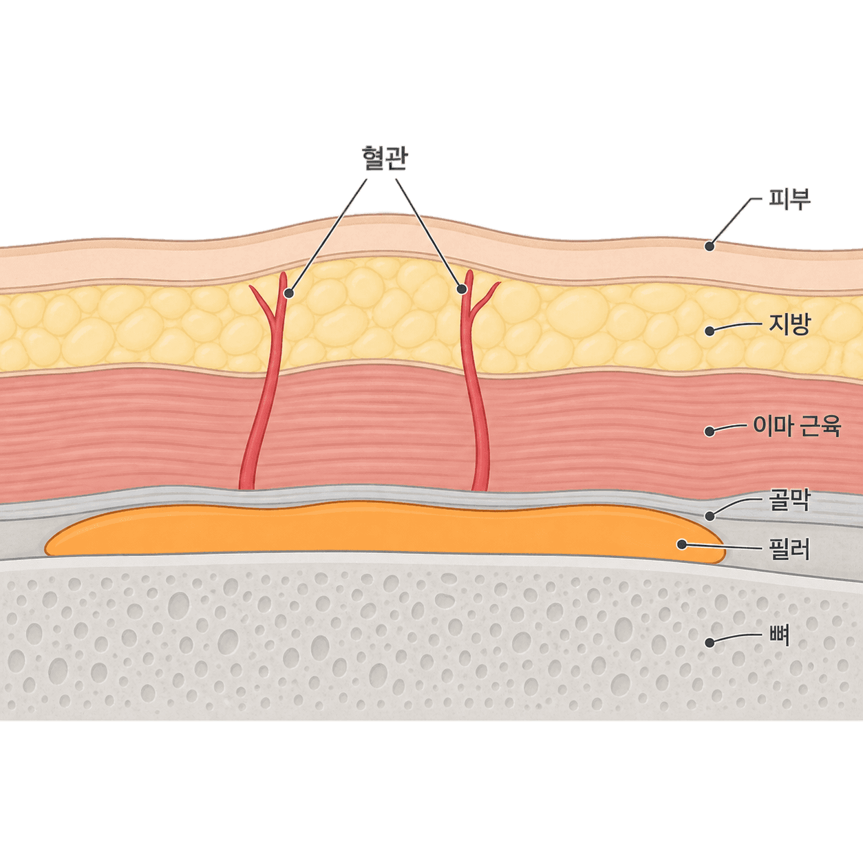 이마 필러는 혈관이 지나는 층을 피해 뼈 가까이에 넓게 펴요.