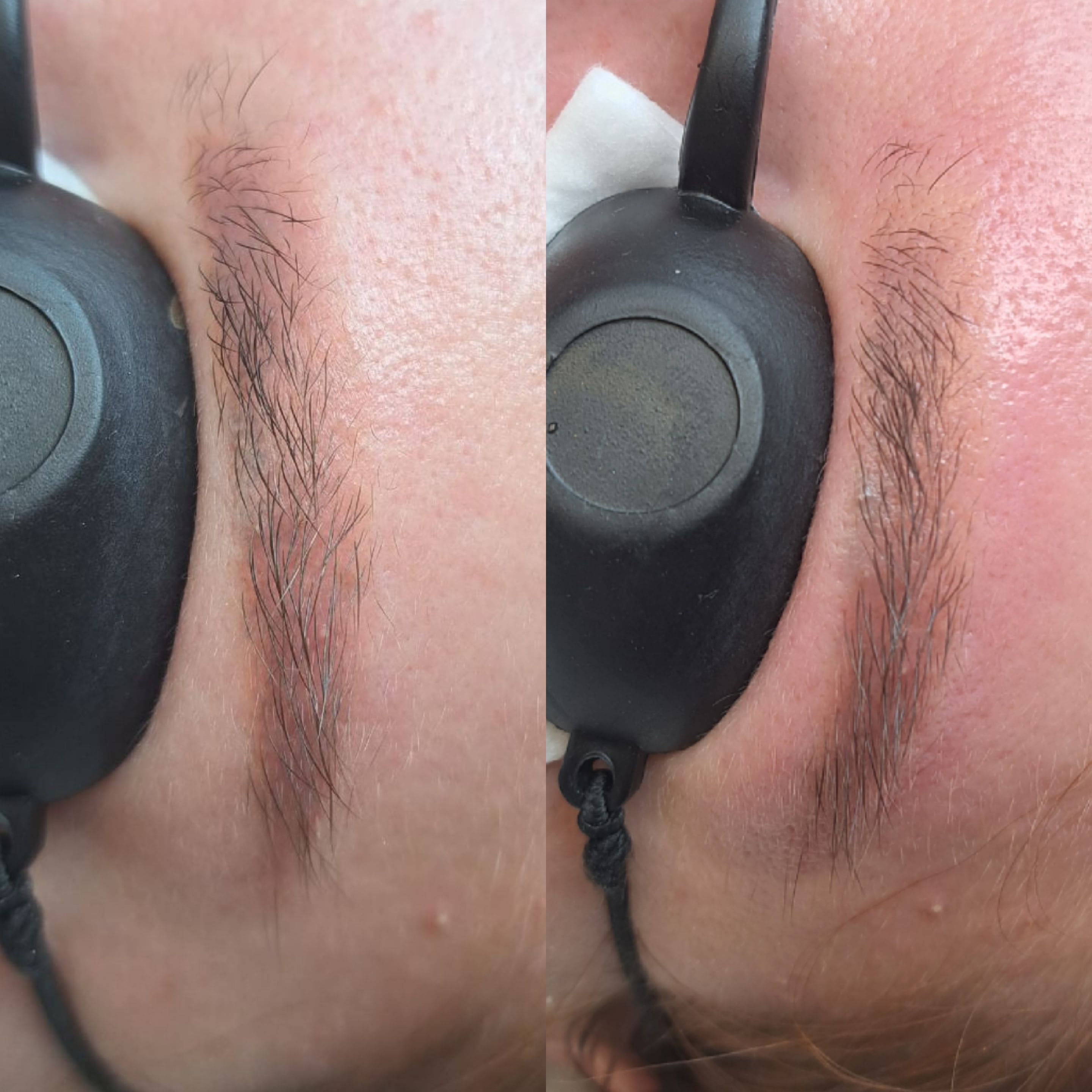 Neutralizacja usuwanie_makijazÌu_permanentnrgo_leszczenko_szczecin