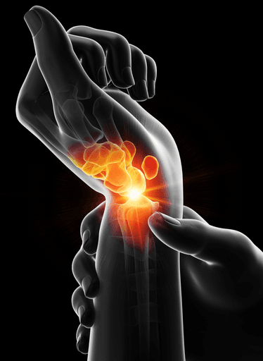 dolor de muñeca representado en arte 3D