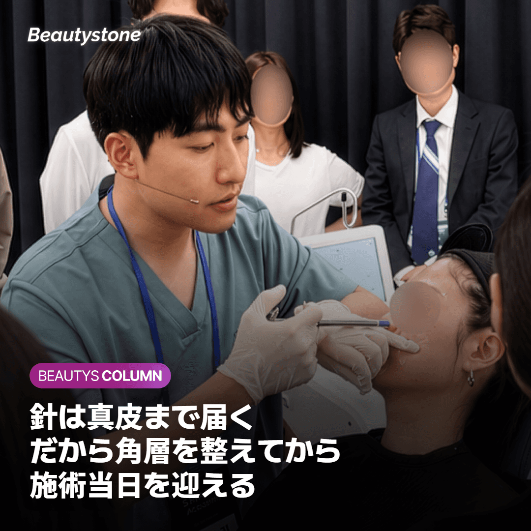 なぜポテンツァの前にホームケアを一度止めるのか