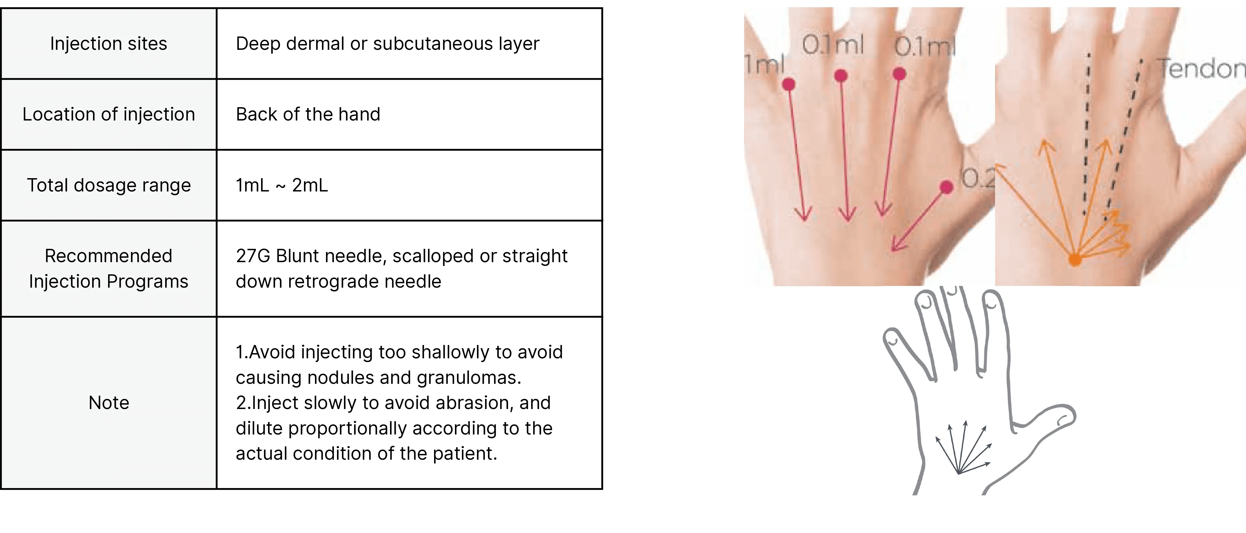 injection area-back of hand effect