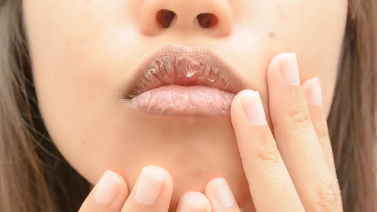 How to Manage Dry Mouth While Using Tirzepatide
