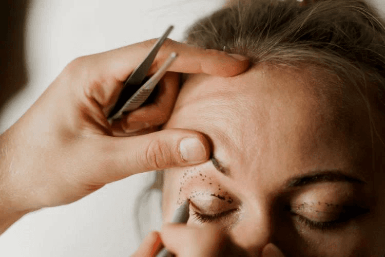 Expertos en Blefaroplastia completa en Terrassa, Barcelona. Heaven Clinics