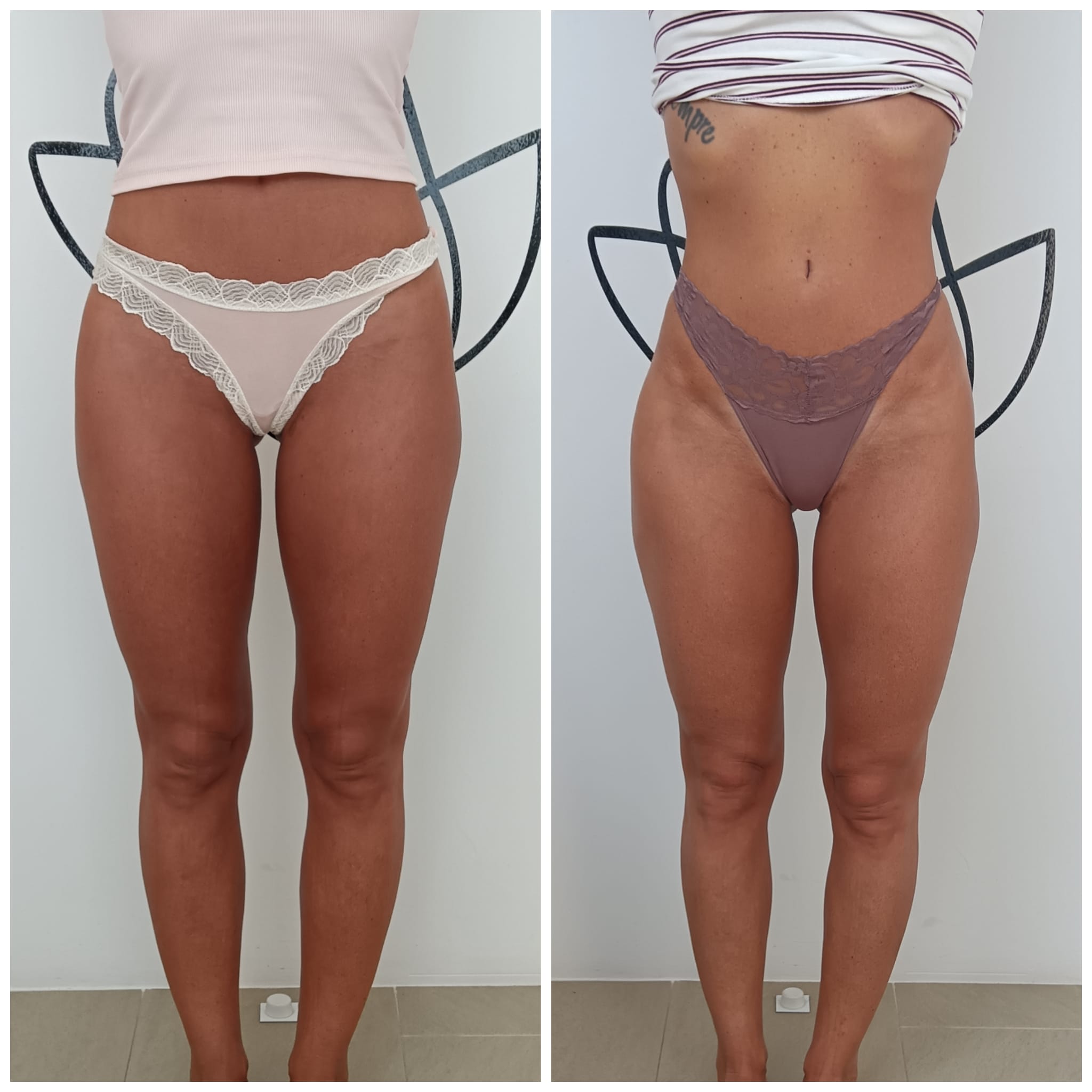 Transformation Photo