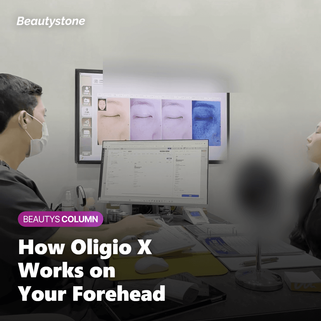 Can It Actually Lift a Heavy Brow?