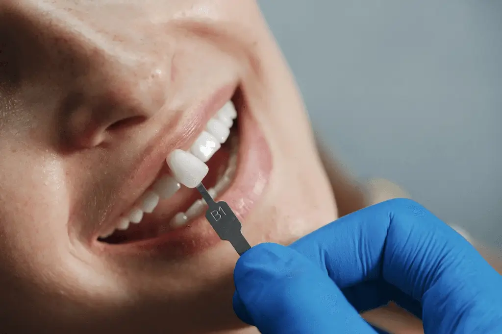 porcelain-veneers-piara-waters