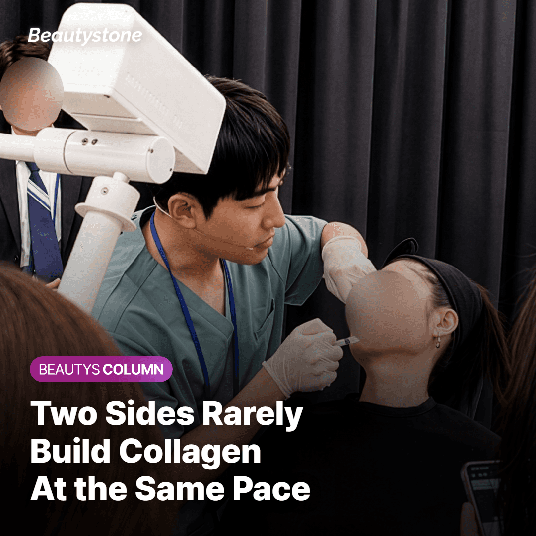 Why the two sides of a face build collagen at different speeds after Sculptra