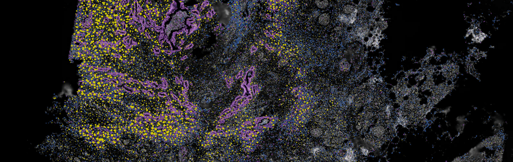 Rosalind-Study-Cure51-Exceptional-Cancer-Survivors