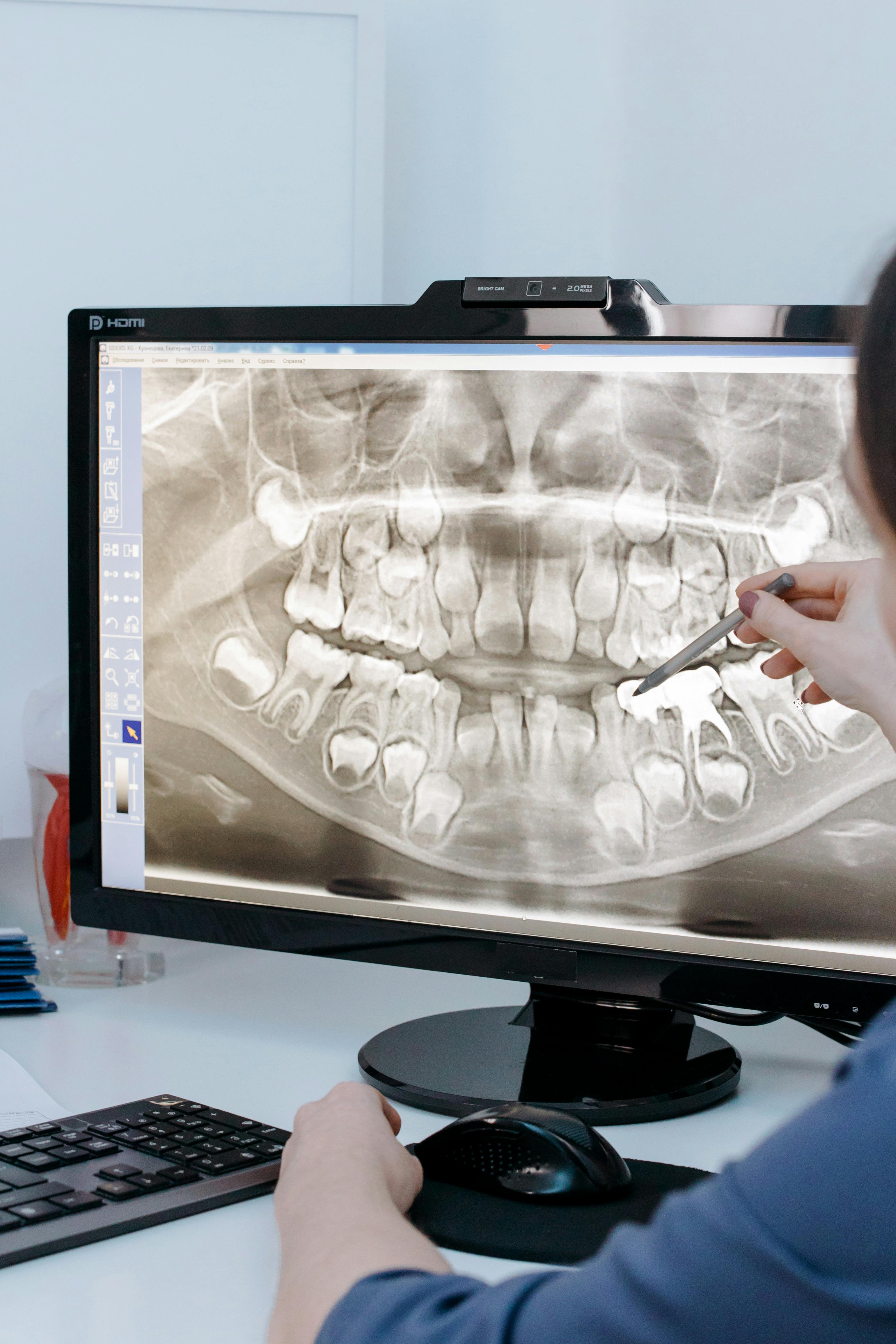 3D Dental X-Rays in Scarborough, ON | Top-Rated Dentist in Scarborough, ON.