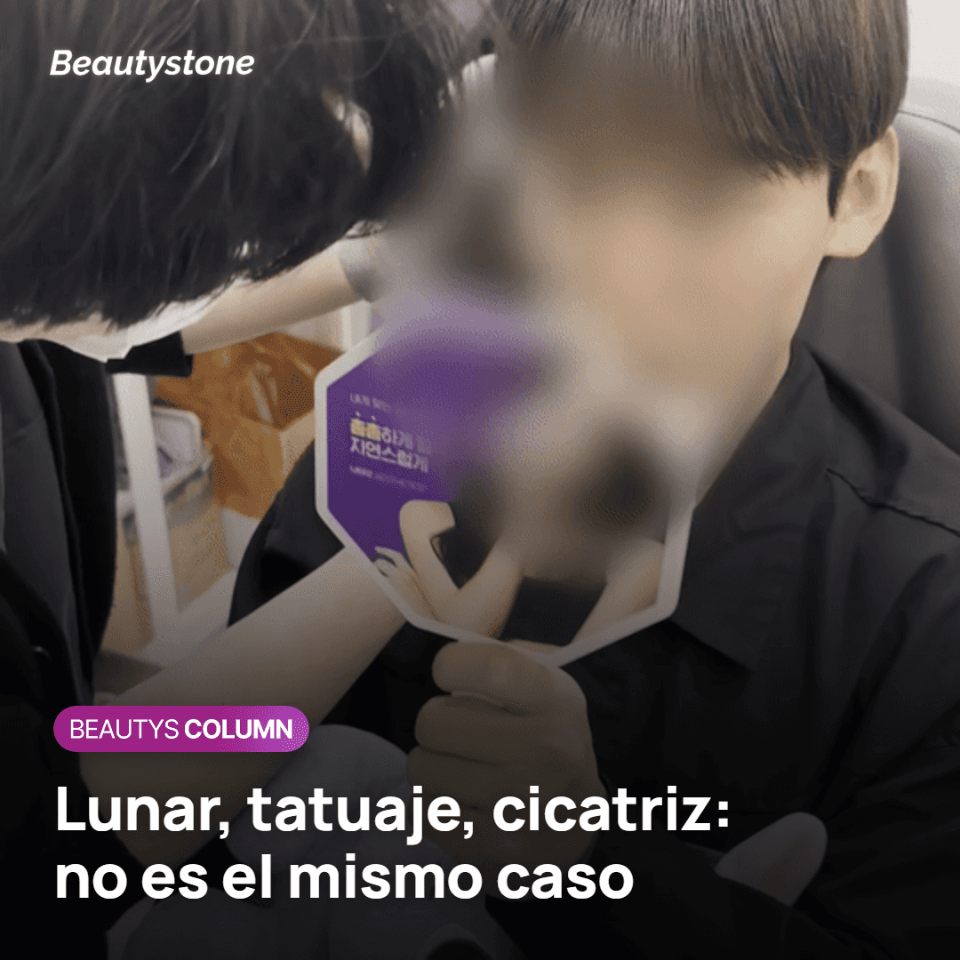 Tabla comparativa de lunares, tatuajes, cicatrices y queloides en depilación láser