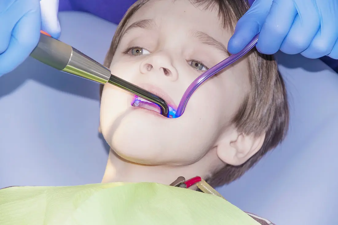 Laser Therapy for child at Shirlington Pediatric Dentistry