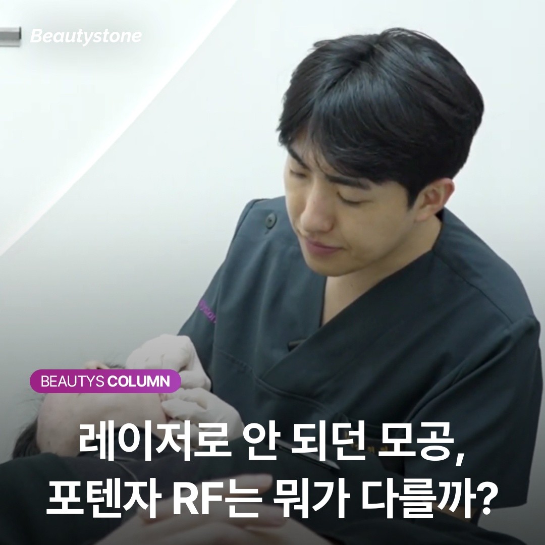레이저로 안 되던 모공, '포텐자 RF'가 풀어낸 진피층 구조의 비밀