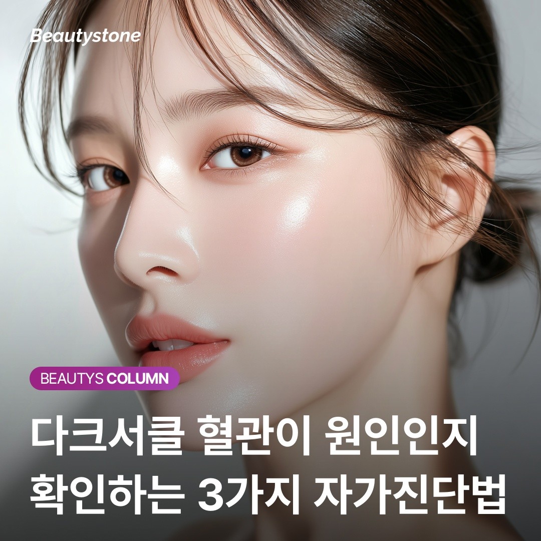 레이저 10번 받아도 안 없어지는 다크서클의 진실: "범인은 멜라닌이 아니라 혈관입니다"