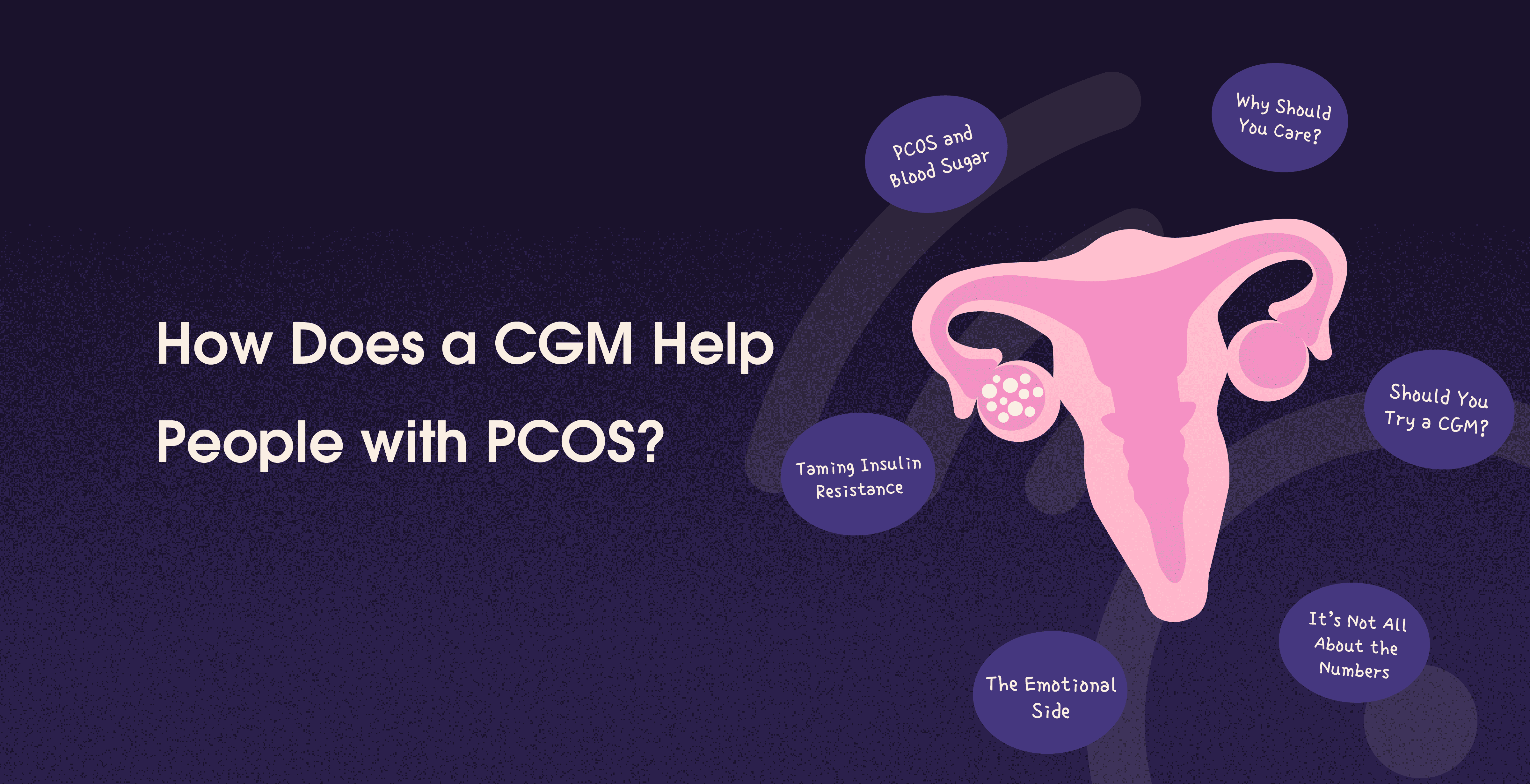 cgm for pcos