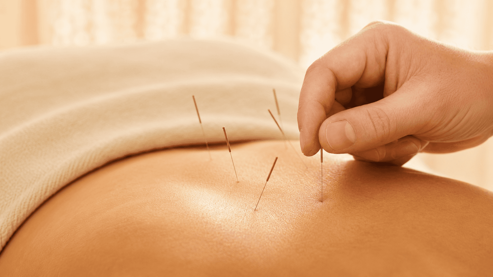 Client receiving clinical acupuncture therapy to support pain relief, recovery, and overall well-being at Ember & Ice Health in Bangalore.