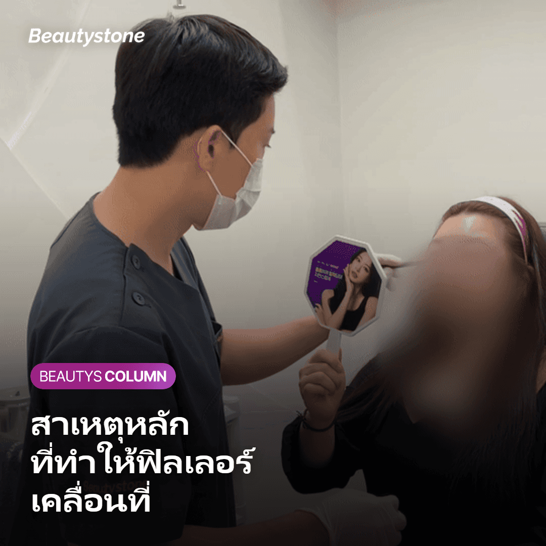 ภาพแสดงสาเหตุหลักที่ทำให้ฟิลเลอร์เคลื่อนที่