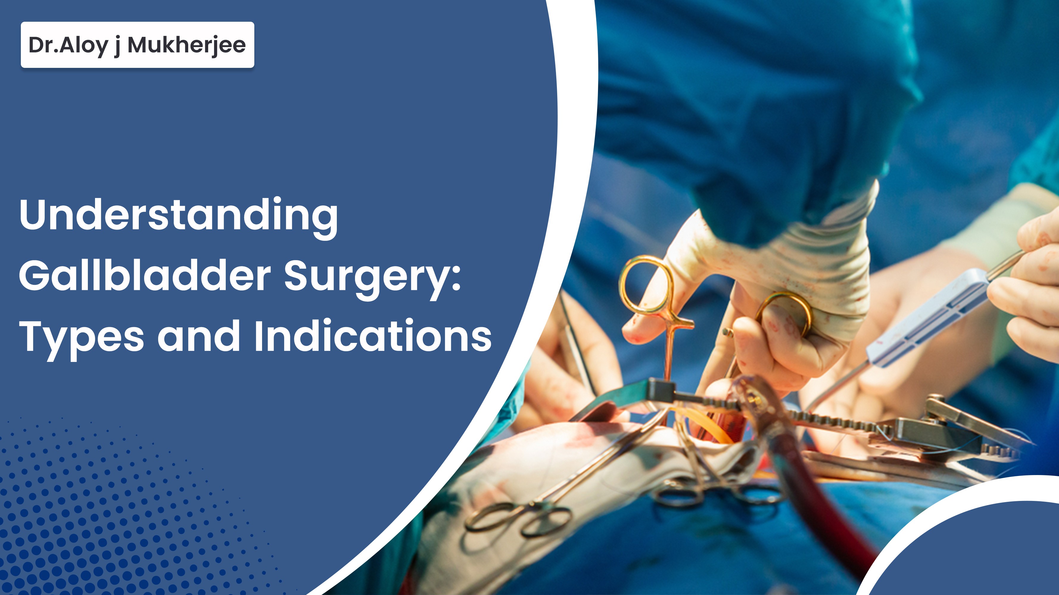 Understanding Gallbladder Surgery: Types and Indications - Aloy Mukherjee