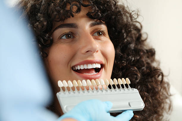 porcelain veneers