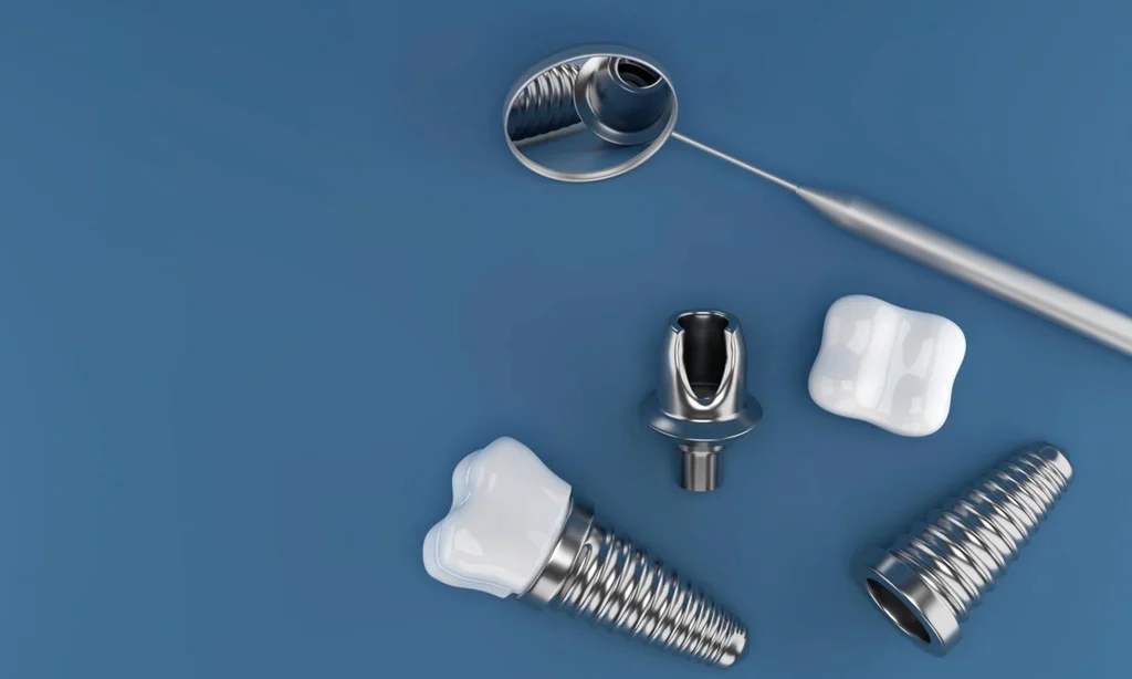 dental implants candidacy