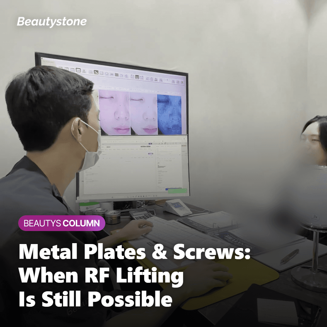 Orthopedic Hardware: Plates, Screws & Joint Replacements