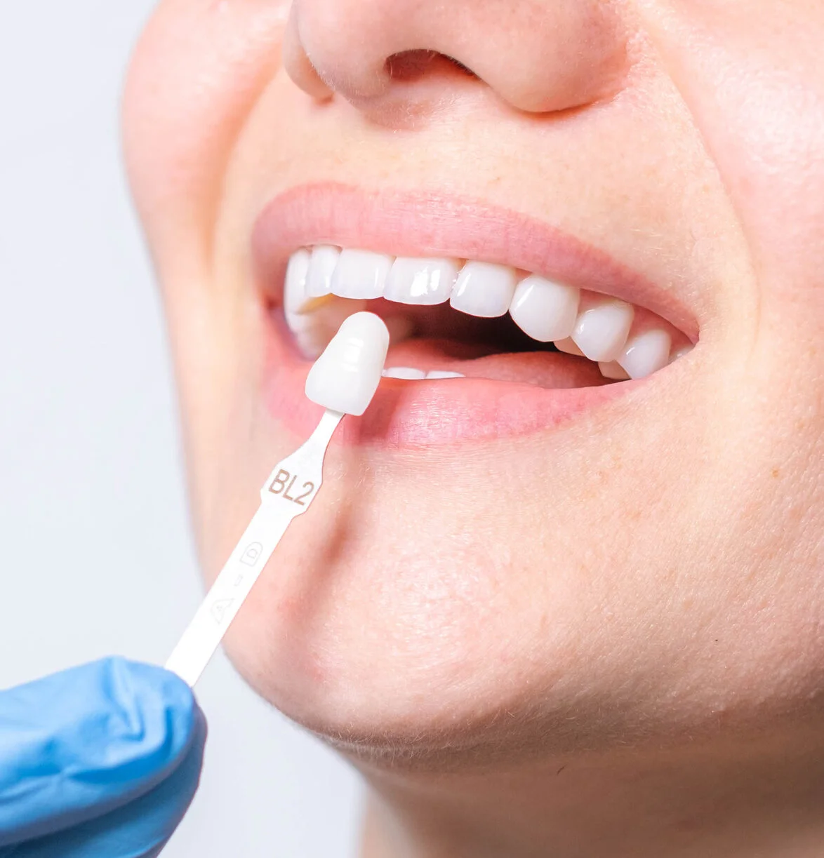 a dentist working on a patient