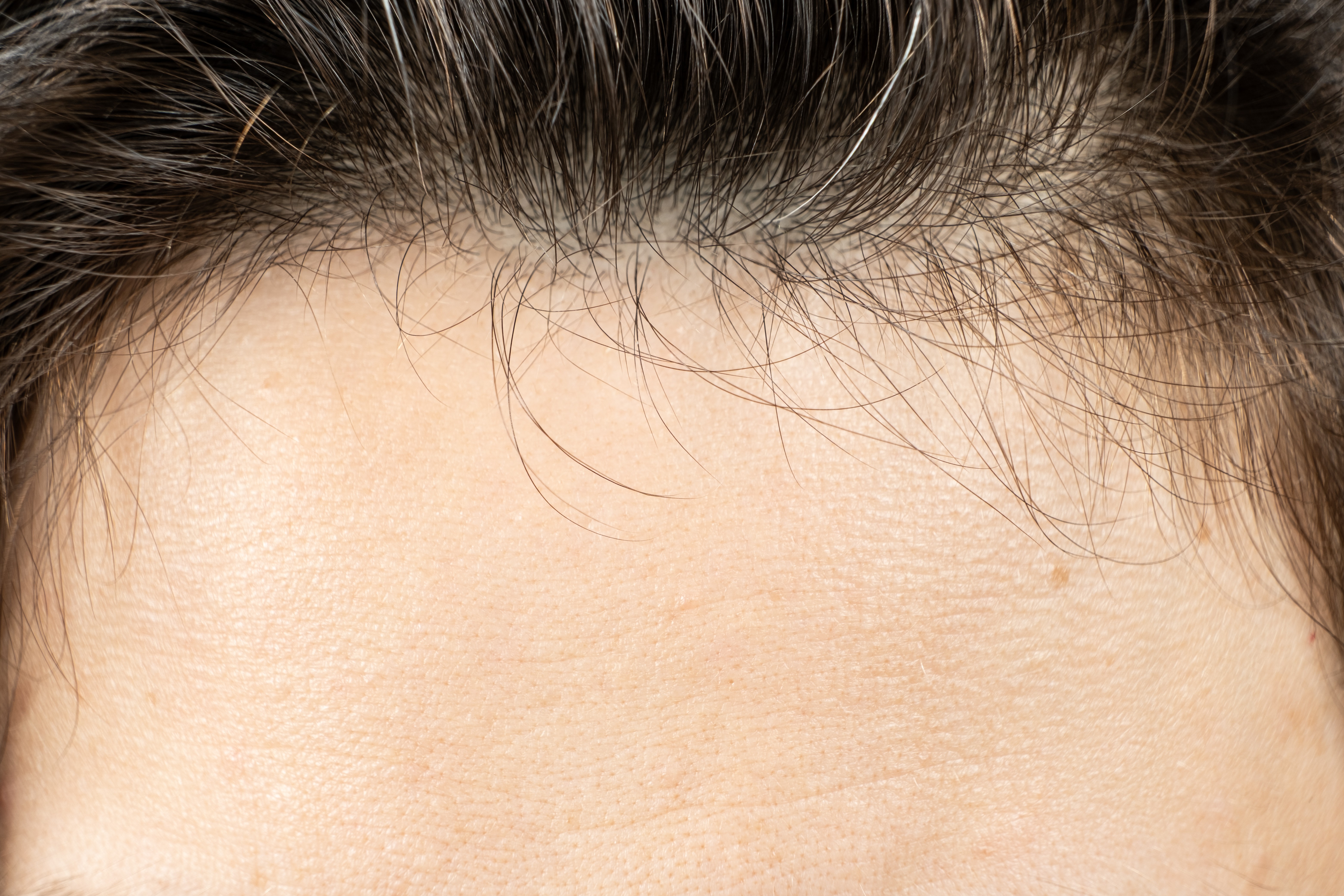 How can you tell if minoxidil is working? Discover the signs of progress, from reduced shedding and new growth to improved density, and when to assess your results.