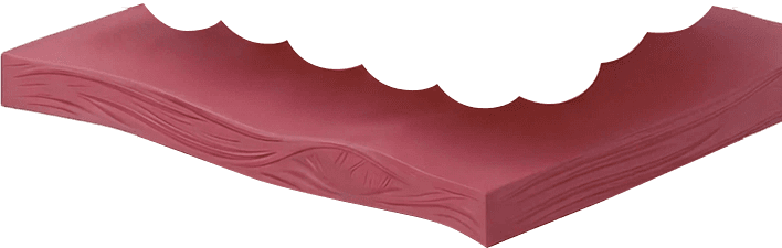 마이크로웨이브 선택 가열 방식 — 고정 깊이 없이 지방세포 선택 타겟