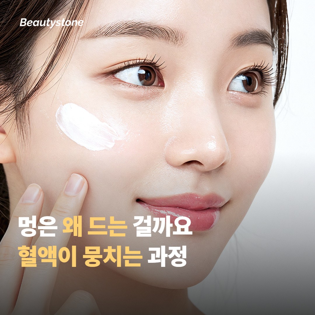 멍은 왜 드는 걸까요, 혈액이 뭉치는 원리 이야기예요