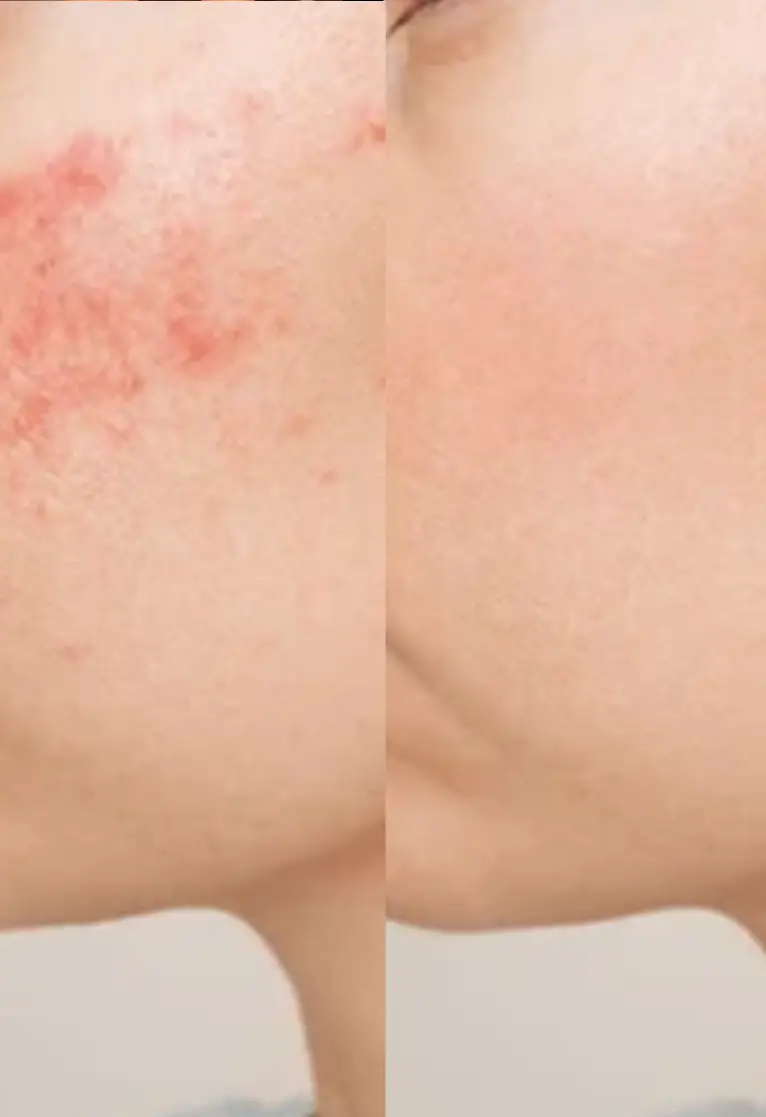 Before and after treatment 