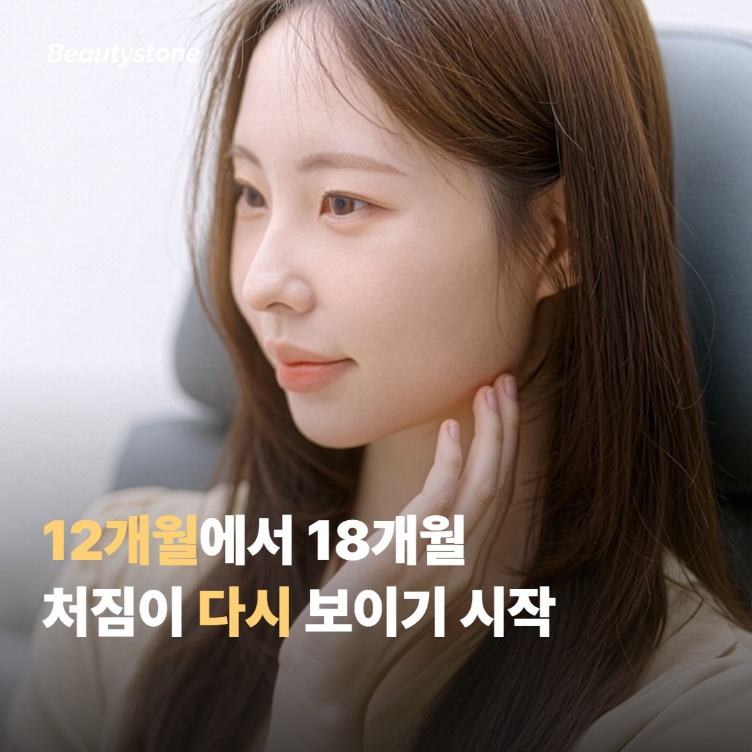 처짐이 다시 보이기 시작하는 건 12~18개월쯤이 일반적이에요
