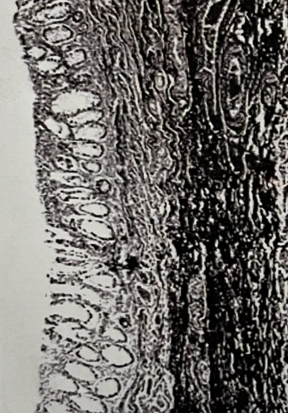 9 Jahre Kind, Fasern in der Submukosa eines 9-jährigen Kindes