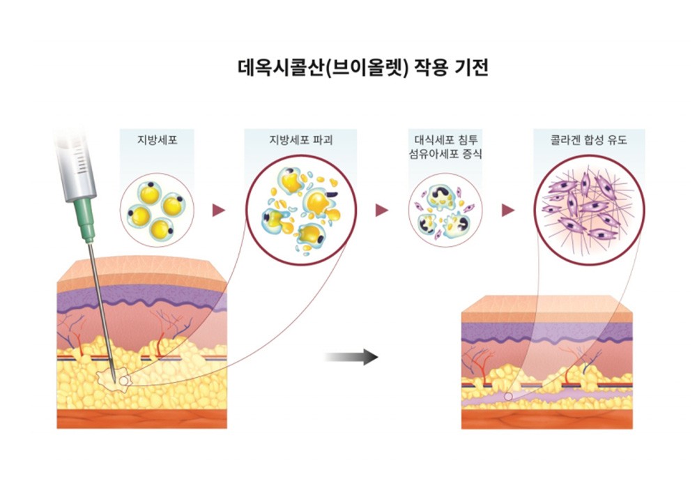 deoxycholic acid working mechanism