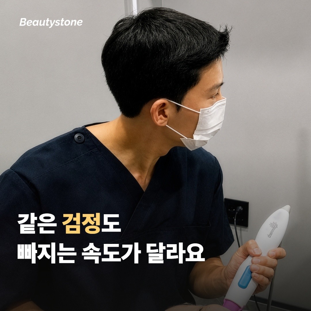 같은 검정이라도 시술 횟수가 다른 이유가 있어요