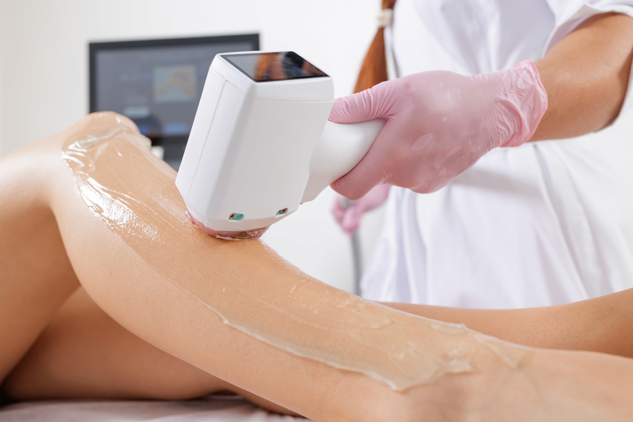 Laser Hair Removal