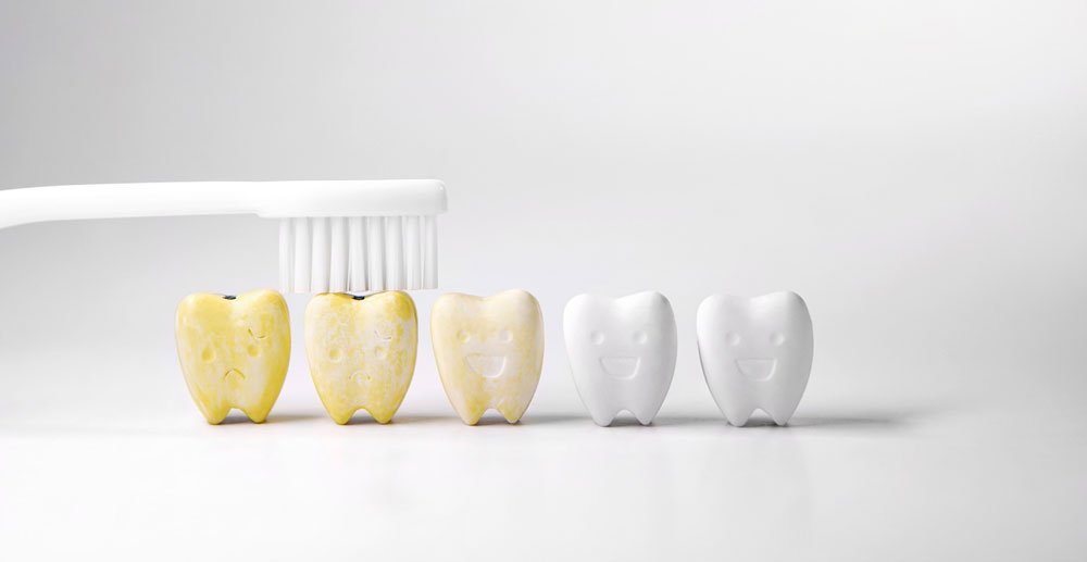 A importância de prevenir e tratar o tártaro