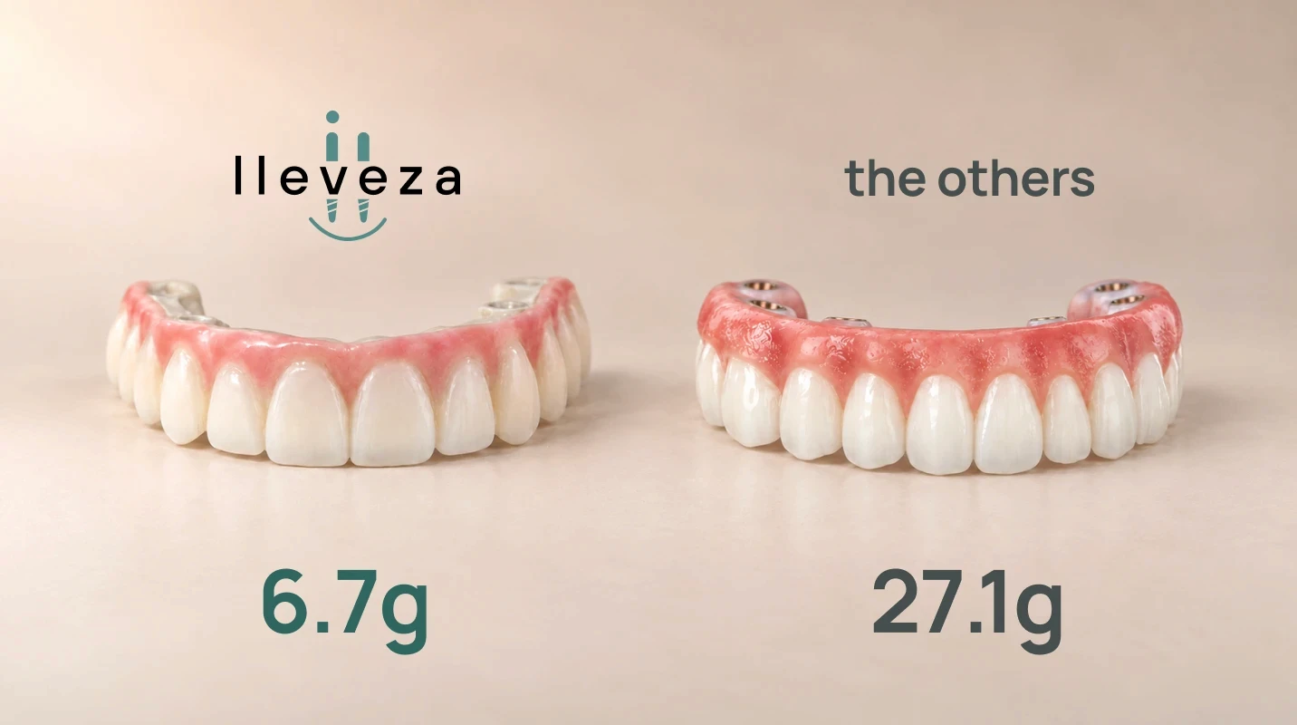 Comparison of lleveza high-performance polymer versus zirconia for full-arch dental implants