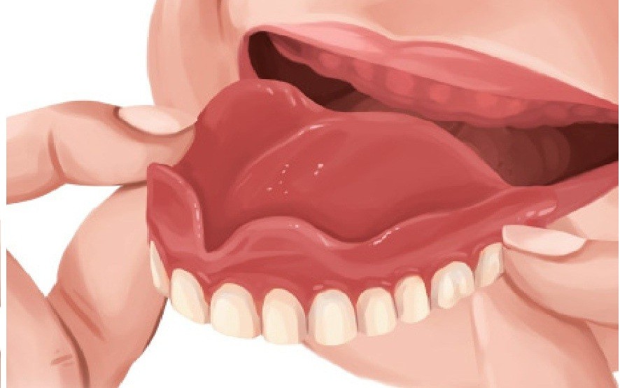 Denture care image