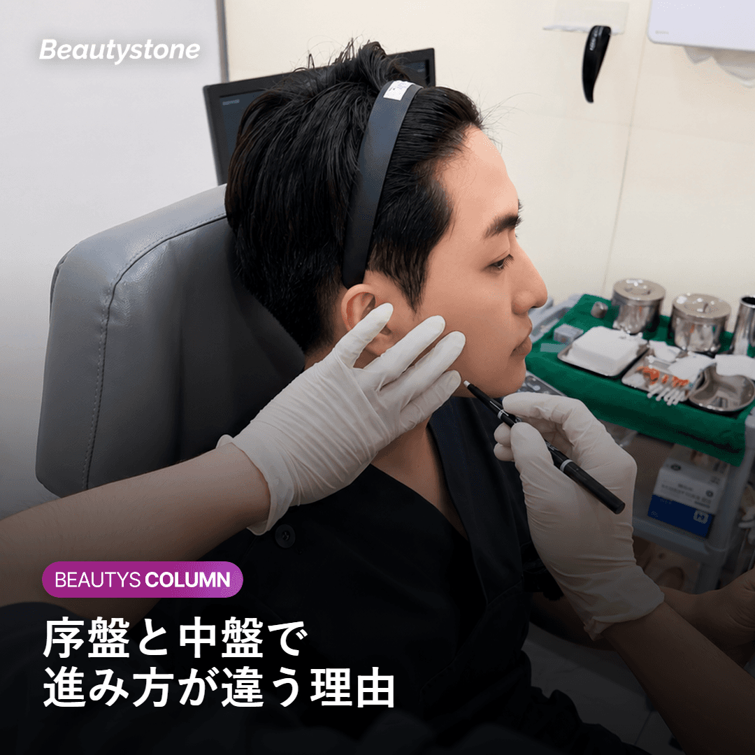 浅く大きい粒子から先に砕けるため序盤ほど見た目の変化が大きくなる仕組み