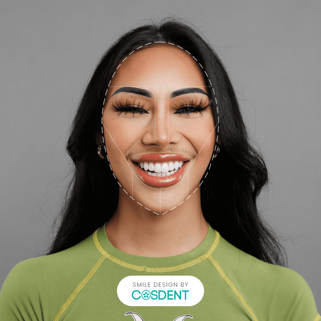 หน้าเชิงมุม ยิ้มกว้าง 16 ซี่