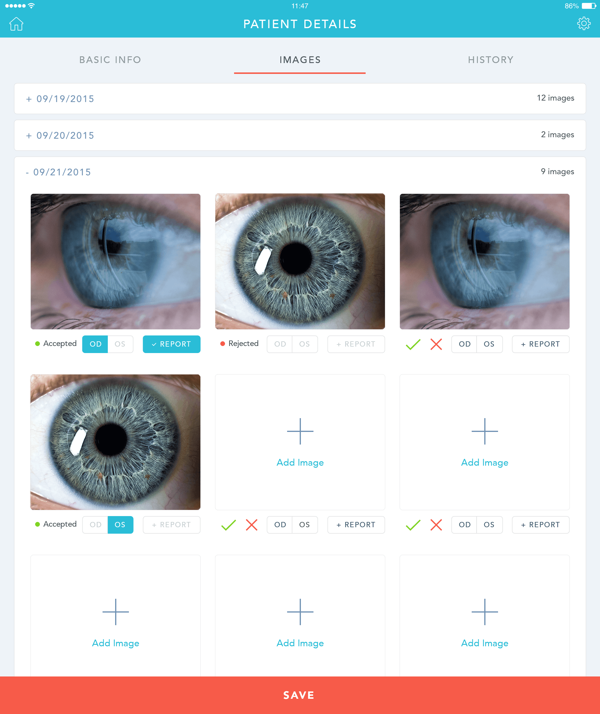 JLP healthcare ERP and retinal camera intelligence