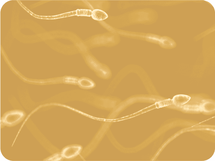 Sperm swimming, magnified by a miscroscope