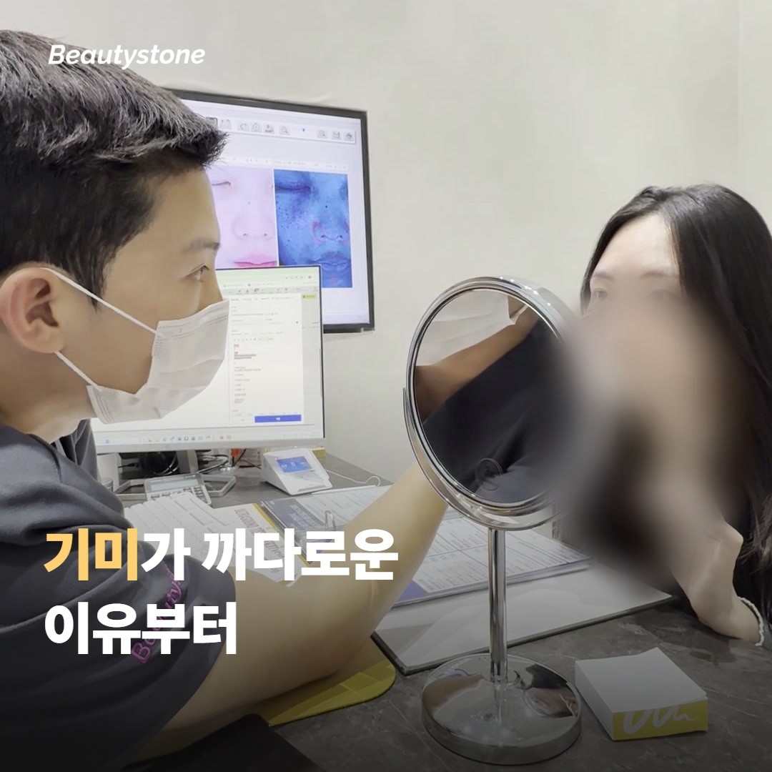 기미 앞에서 레이저만으로는 망설여지는 이유