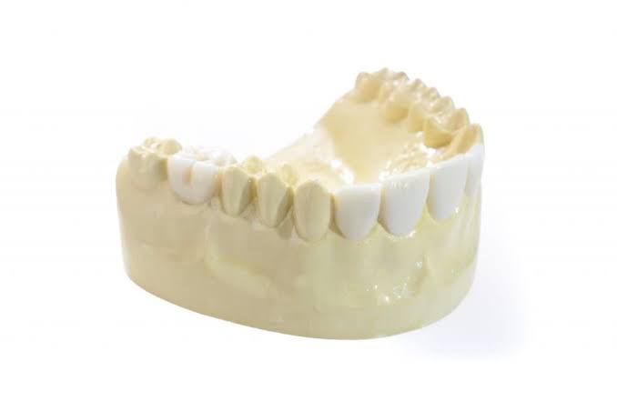 Patient placing a clear dental aligner over her teeth