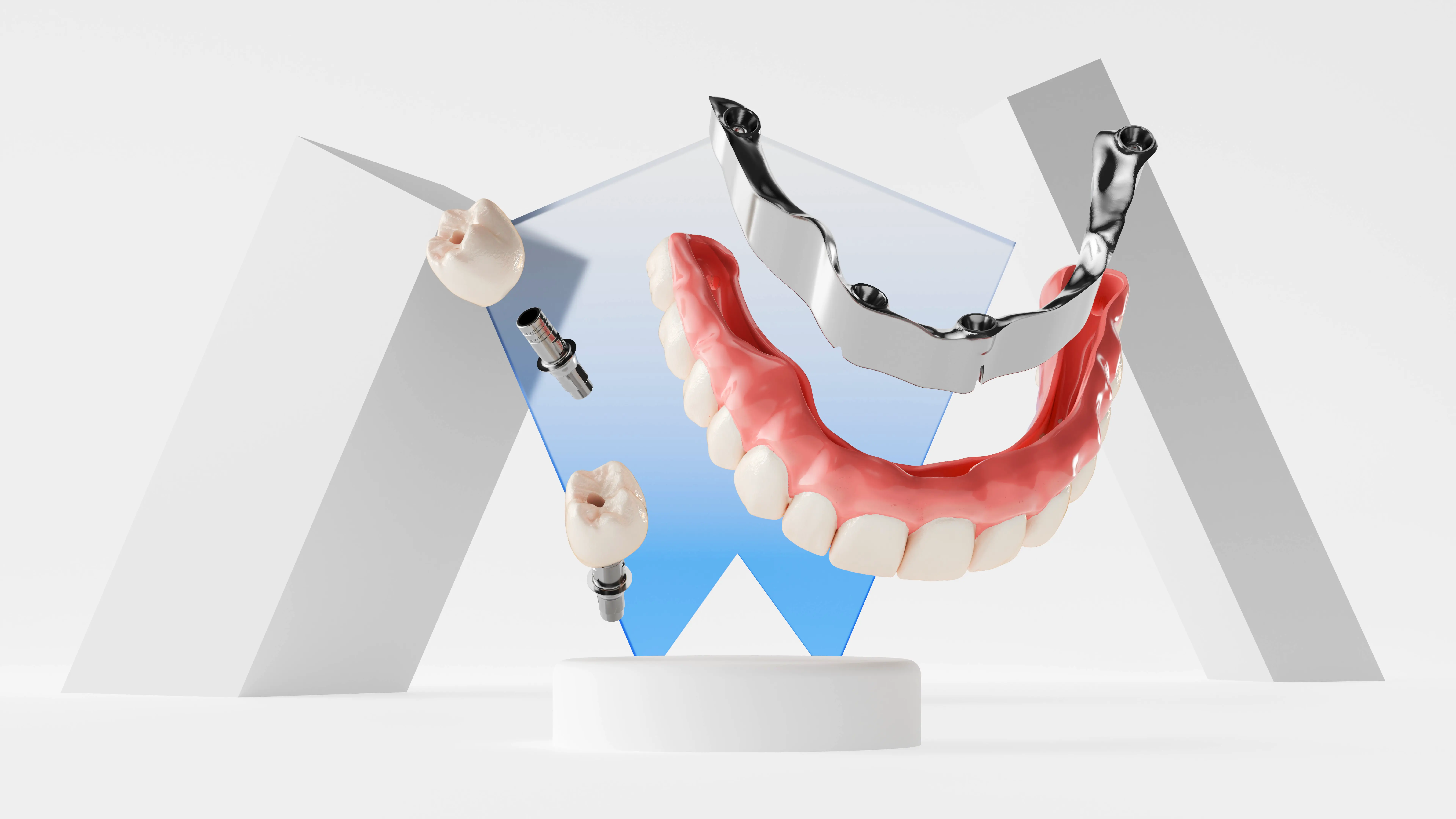 3D vizualizacija vaizduojanti dantų protezų ir implantų sistemą – tikslus anatominis atvaizdas su metalo karkasu, sukurta Renderiai.