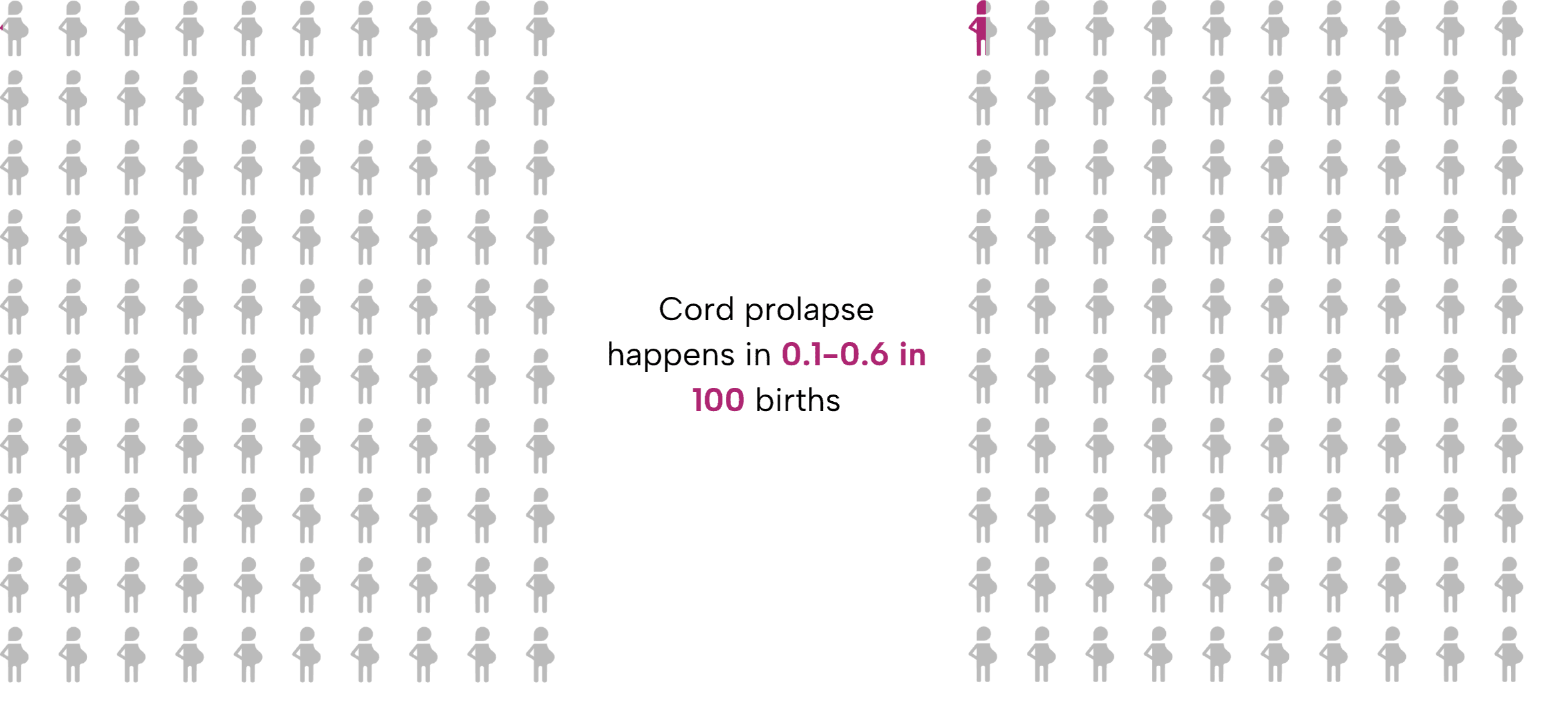 Comparative array diagrams showing 0.1-0.6 in 100 pregnant women of 100 filled in - cord prolapse happens in 0.1-0.6 in 100 births